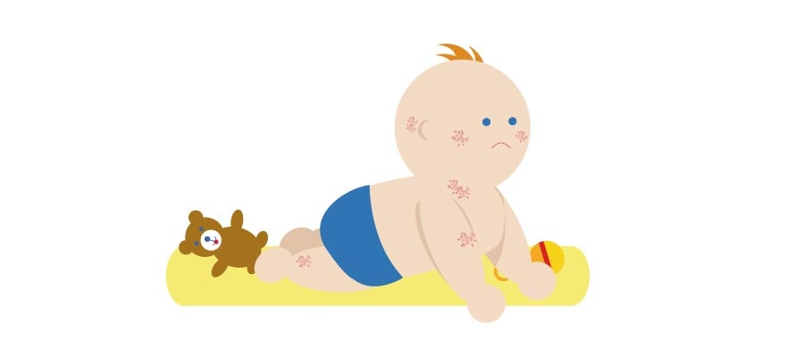 Salud del bebé - ilustración manchas