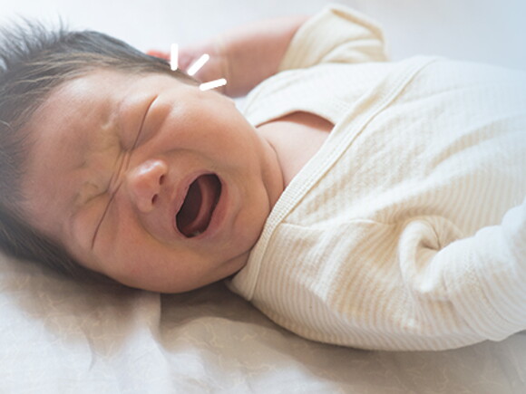 El llanto del bebé o el cólico del lactante