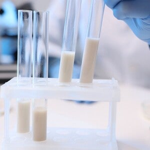 Fotografía: tubos de ensayo con líquido lechoso y mano con guante azul en laboratorio