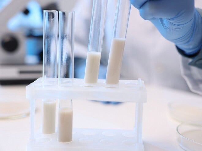 Fotografía: tubos de ensayo con líquido lechoso y mano con guante azul en laboratorio