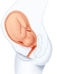 Cuerpo a 32 semanas de embarazo Cuerpo a 32 semanas de embarazo